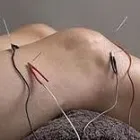 Business 4 image ACUPUNCTURE CHINOISE À MONTRÉAL - ZHIFANG(LILY) ZHAI Health & Medicine in Montréal QC
