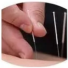 Business 1 image ACUPUNCTURE CHINOISE À MONTRÉAL - ZHIFANG(LILY) ZHAI Health & Medicine in Montréal QC