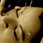 Entreprises 2 image ACUPUNCTURE VINCENT LEFÈVRE Health & Medicine dans Montréal QC