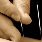 Entreprises 6 image ACUPUNCTURE VINCENT LEFÈVRE Health & Medicine dans Montréal QC