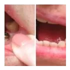 Entreprises 13 image ALL ABOUT FAMILY DENTAL Health & Medicine dans Calgary AB