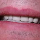 Entreprises 6 image ALL ABOUT FAMILY DENTAL Health & Medicine dans Calgary AB