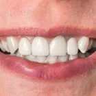 Business 1 image AMIRAD FAMILY DENTISTRY Cosmetic Dentistry in Toronto ON