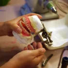 Entreprises 1 image ANDERSON PTAK DENTURE CLINIC LTD Health & Medicine dans Coquitlam BC