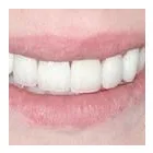 Business 5 image BITE DENTAL WORKS Health & Medicine in Calgary AB