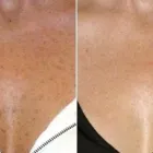 Business 2 image BODY BENEFITS DAY SPA & MEDI-SPA Hair Removal Services in London ON
