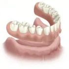 Business 11 image BROOKSWOOD DENTURE CLINIC LTD Health & Medicine in Langley BC