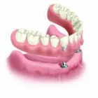 Business 12 image BROOKSWOOD DENTURE CLINIC LTD Health & Medicine in Langley BC