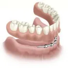 Business 19 image BROOKSWOOD DENTURE CLINIC LTD Health & Medicine in Langley BC