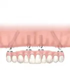Business 21 image BROOKSWOOD DENTURE CLINIC LTD Health & Medicine in Langley BC