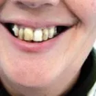 Business 10 image BURNETT DENTURE CLINIC Health & Medicine in Kelowna BC