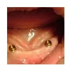 Business 12 image BURNETT DENTURE CLINIC Health & Medicine in Kelowna BC