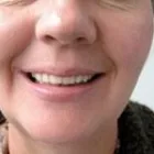 Business 14 image BURNETT DENTURE CLINIC Health & Medicine in Kelowna BC