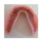 Business 3 image BURNETT DENTURE CLINIC Health & Medicine in Kelowna BC