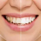 Business 5 image CENTRAL BURLINGTON DENTAL Dentists in Burlington ON