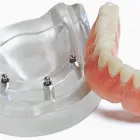 Business 3 image CHRISTIAN DEMEURIE DENTUROLOGISTE Prosthodontists, Endodontists & Periodontists in Montréal QC
