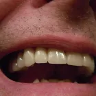 Business 1 image CHRISTIAN DEMEURIE DENTUROLOGISTE Prosthodontists, Endodontists & Periodontists in Montréal QC