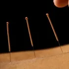 Entreprises 1 image CLINIQUE D'ACUPUNCTURE DE QUÉBEC Health & Medicine dans Québec QC