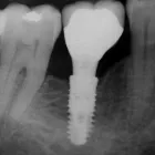 Business 4 image CLINIQUE DENTAIRE DR.MANSOURI | DENTISTE GATINEAU Health & Medicine in Gatineau QC