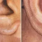 Entreprises 4 image COMFORT BLEND ELECTROLYSIS Hair Removal Services dans Peterborough ON