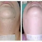 Entreprises 7 image COMFORT BLEND ELECTROLYSIS Hair Removal Services dans Peterborough ON