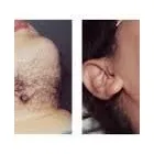 Entreprises 8 image COMFORT BLEND ELECTROLYSIS Hair Removal Services dans Peterborough ON