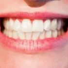 Business 3 image DENTUROLOGISTE ANJOU Prosthodontists, Endodontists & Periodontists in Montréal QC