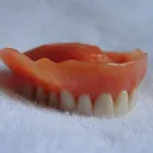 Business 7 image DENTUROLOGISTE ANJOU Prosthodontists, Endodontists & Periodontists in Montréal QC