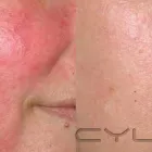 Business 17 image DERMCARE Skin Care Clinics & Services in Mississauga ON