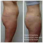 Entreprises 1 image DR. MICHAEL KREIDSTEIN PLASTIC AND COSMETIC SURGERY CLINIC Plastic & Cosmetic Surgery dans North York ON