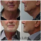 Entreprises 2 image DR. MICHAEL KREIDSTEIN PLASTIC AND COSMETIC SURGERY CLINIC Plastic & Cosmetic Surgery dans North York ON