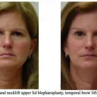 Entreprises 3 image DR. MICHAEL KREIDSTEIN PLASTIC AND COSMETIC SURGERY CLINIC Plastic & Cosmetic Surgery dans North York ON