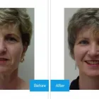 Business 1 image DR. MICHAEL KREIDSTEIN Plastic & Cosmetic Surgery in North York ON