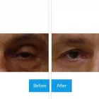 Business 4 image DR. MICHAEL KREIDSTEIN Plastic & Cosmetic Surgery in North York ON