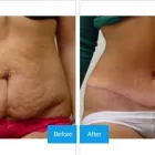 Business 5 image DR. MICHAEL KREIDSTEIN Plastic & Cosmetic Surgery in North York ON