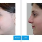 Business 6 image DR. MICHAEL KREIDSTEIN Plastic & Cosmetic Surgery in North York ON