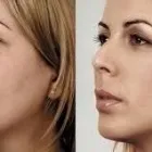 Business 11 image DR. POON COSMETIC MEDICINE INC Health & Medicine in Mississauga ON