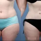 Business 15 image DR. POON COSMETIC MEDICINE INC Health & Medicine in Mississauga ON