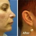 Business 22 image DR. POON COSMETIC MEDICINE INC Health & Medicine in Mississauga ON