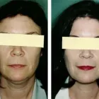 Business 23 image DR. POON COSMETIC MEDICINE INC Health & Medicine in Mississauga ON