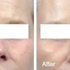 Business 25 image DR. POON COSMETIC MEDICINE INC Health & Medicine in Mississauga ON