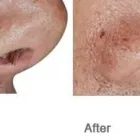 Business 26 image DR. POON COSMETIC MEDICINE INC Health & Medicine in Mississauga ON