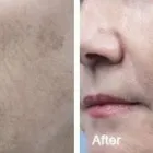 Business 28 image DR. POON COSMETIC MEDICINE INC Health & Medicine in Mississauga ON