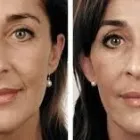 Business 31 image DR. POON COSMETIC MEDICINE INC Health & Medicine in Mississauga ON