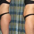 Business 35 image DR. POON COSMETIC MEDICINE INC Health & Medicine in Mississauga ON