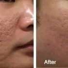 Business 36 image DR. POON COSMETIC MEDICINE INC Health & Medicine in Mississauga ON