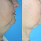 Business 37 image DR. POON COSMETIC MEDICINE INC Health & Medicine in Mississauga ON