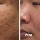 Business 42 image DR. POON COSMETIC MEDICINE INC Health & Medicine in Mississauga ON