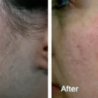 Business 43 image DR. POON COSMETIC MEDICINE INC Health & Medicine in Mississauga ON