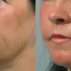 Business 44 image DR. POON COSMETIC MEDICINE INC Health & Medicine in Mississauga ON